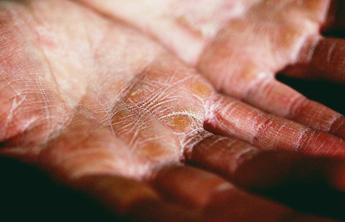 ofiste susuzluğun etkileri